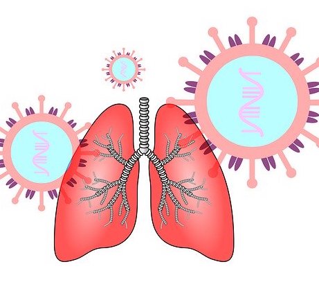 koronawirus, chore płuca